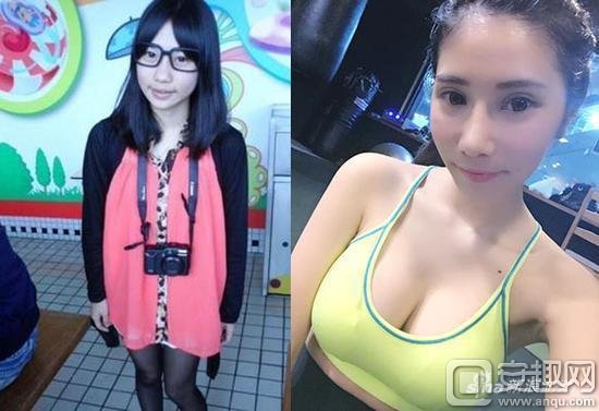 LOL女主播自曝整形前照片：全身7个部位大变样